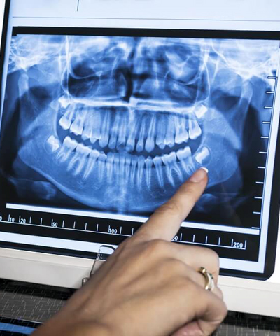 Radiologia Oral Digital